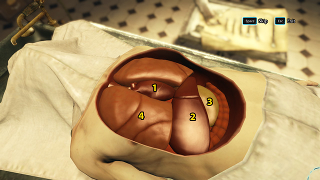 1 - Heart, 2 - Liver, 3 - Stomach, 4 - Lungs. - Sherlock Holmes Crimes and Punishments: Perform an autopsy on Montague Dunne - Sherlock Holmes Crimes and Punishments: The Kew Gardens Drama - Sherlock Holmes: Crimes and Punishments Game Guide