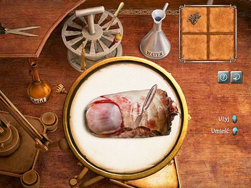 Finally, using the scalpel (the one from stand) examine the finger in the bitten place and where the bone is visible - Check the Collected Evidences | The Murder in Diocese of Knightsbridge - The Murder in Diocese of Knightsbridge - The Testament of Sherlock Holmes Game Guide