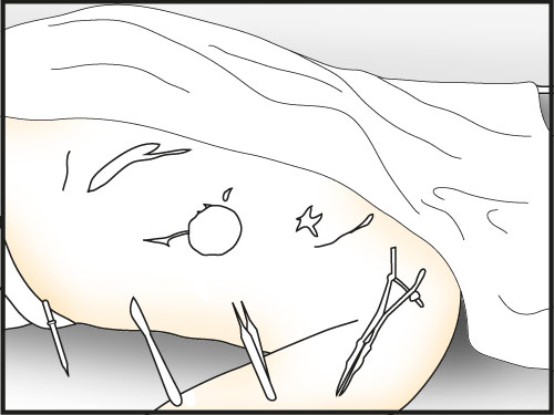 clean mans side with gauze - Make a Dissection | Slaughter in Whitechapel - Slaughter in Whitechapel - The Testament of Sherlock Holmes Game Guide