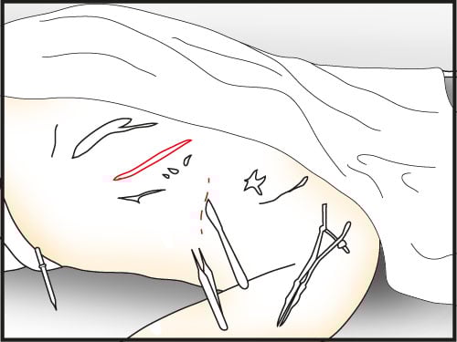 make two cuts with scalpel in marked places - Make a Dissection | Slaughter in Whitechapel - Slaughter in Whitechapel - The Testament of Sherlock Holmes Game Guide