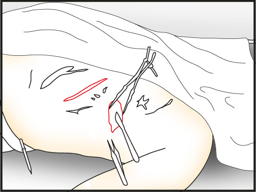 use a rib spreader on the right one and cut deeper - Make a Dissection | Slaughter in Whitechapel - Slaughter in Whitechapel - The Testament of Sherlock Holmes Game Guide