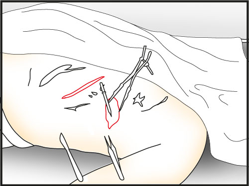 Use pipette on the exposed lungs (it goes to your inventory) - Make a Dissection | Slaughter in Whitechapel - Slaughter in Whitechapel - The Testament of Sherlock Holmes Game Guide