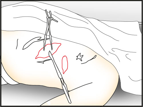 use rib spreader on the second cut and cut deeper with scalpel - Make a Dissection | Slaughter in Whitechapel - Slaughter in Whitechapel - The Testament of Sherlock Holmes Game Guide